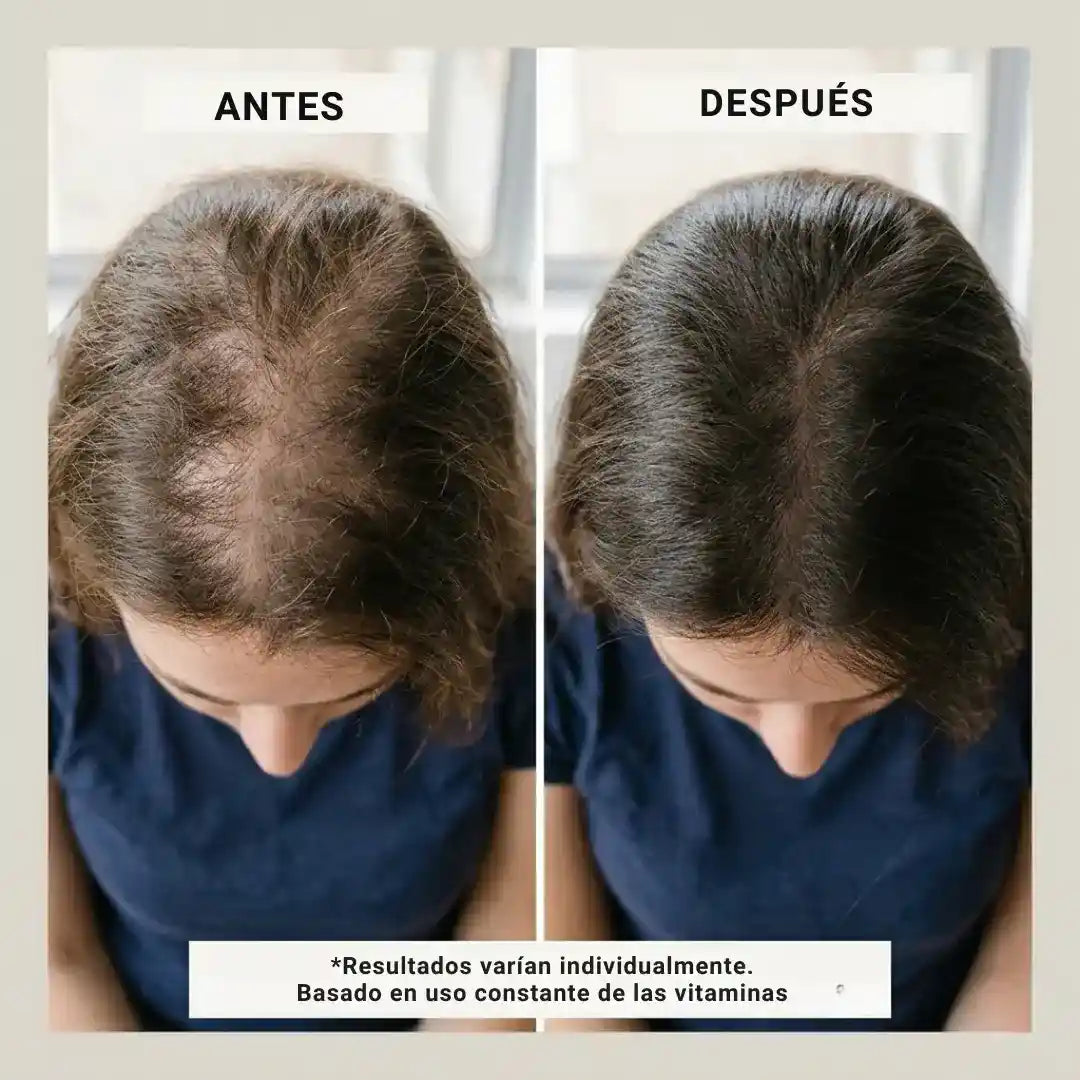 Long Hair Gomitas con Biotina- Recupera la fuerza y el brillo de tu cabello desde la raíz.